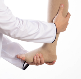 Lymphedema Lymphedema