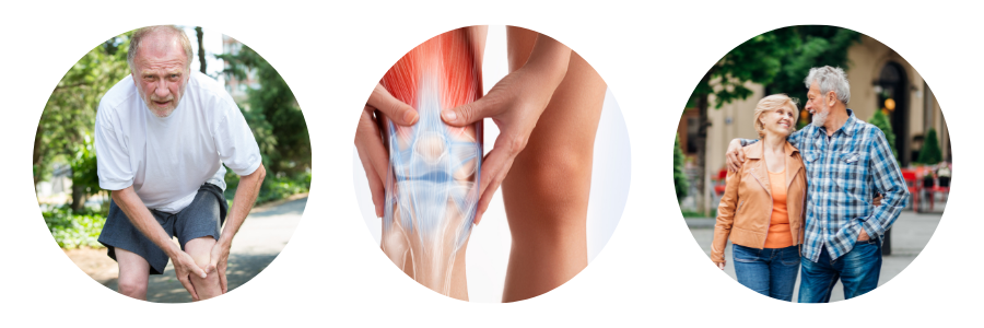 Knee Implant Images Knee Implant Images