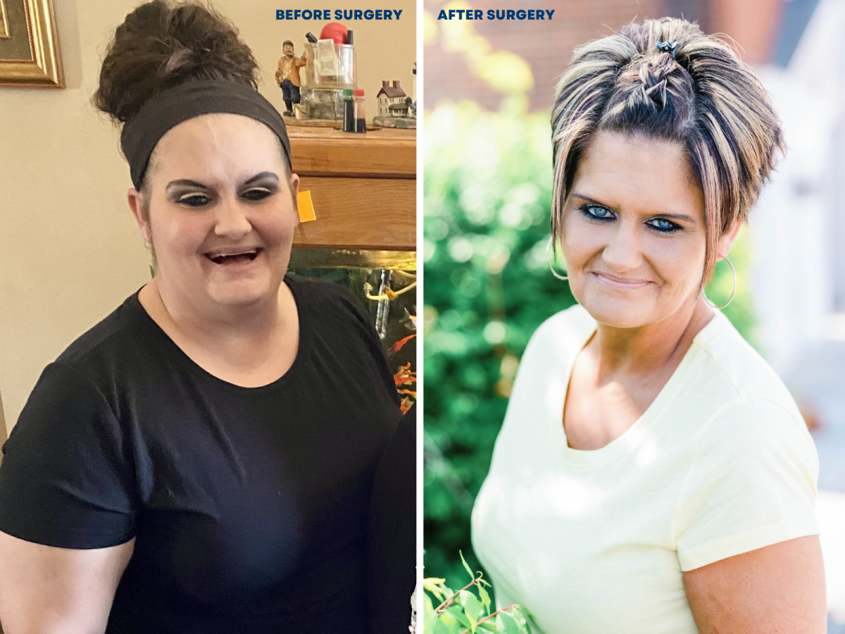 Angela Walden Before/After